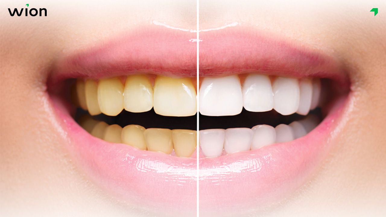 Tận dụng hình ảnh và video minh họa chuyên nghiệp khi đăng content về nha khoa